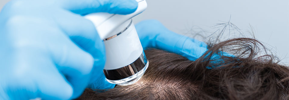 Mit dem auf die Kopfhaut aufgesetzten Trichoskop lassen sich Details wie Haarwurzeln, Haarfollikelöffnungen, Pigmentveränderungen und Gefäße nicht-invasiv und schmerzfrei beurteilen.