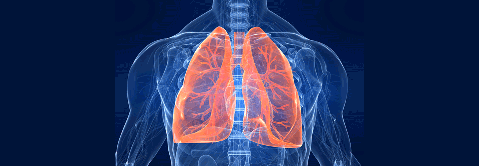 Könnten TTFields zukünftig auch beim metastasierten NSCLC eingesetzt werden?