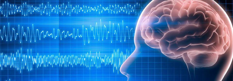 KI's könnten in Zukunft bei der Auswertung von EEGs unterstützen.