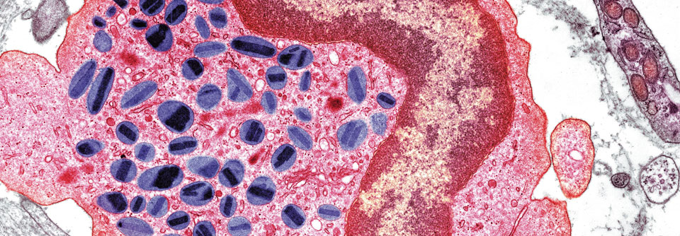 Eosinophile Granulozyten sind Teil des unspezifischen zellulären Immunsystems. In ihrem Zytoplasma (pink) befinden sich neben dem bilobulären Zellkern zahlreiche Granula (blau). Sie enthalten verschiedene basische Proteine, die z.B. an der Abwehr von Parasiten beteiligt sind.