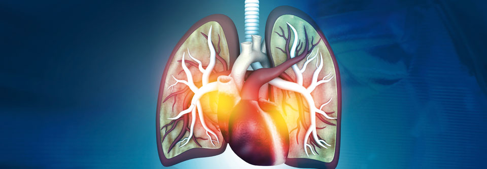 Herz- und Lungengesundheit hängen eng zusammen. Dies muss auch in der COPD-Therapie berücksichtigt werden.