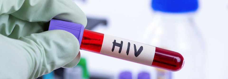 Würden Patienten ganzheitlicher untersucht und behandelt werden, könnte man die HIV-bedingten Todesfälle, laut Dr. Fern ­Pattinson, minimieren.