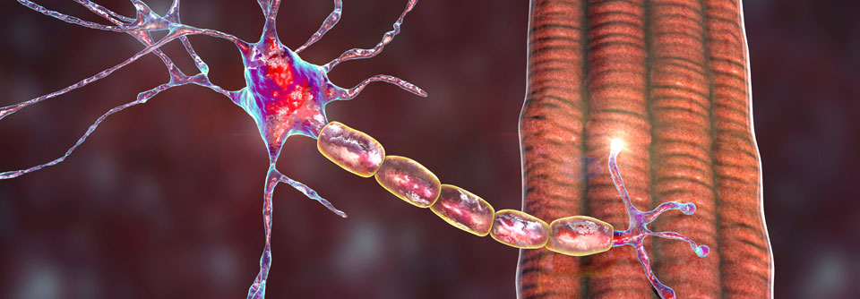 Bei niedrigtitrig erhöhten Acetylcholinrezeptor-Antikörpern ist auch an andere Autoimmunkrankheiten zu denken.