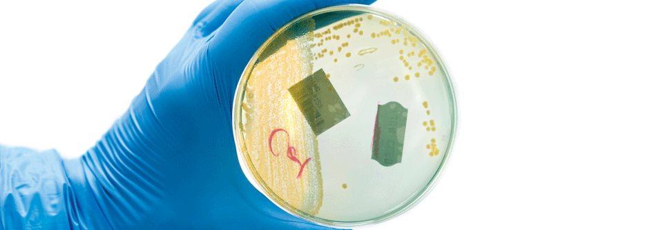 Der alleinige Nachweis coliformer Bakterien in der Urinkultur ist kein ausreichender Grund für eine Antibiotikatherapie.
