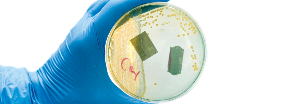 Asymptomatische Bakteriurien zu behandeln ist potenziell gefährlich Der alleinige Nachweis coliformer Bakterien in der Urinkultur ist kein ausreichender Grund für eine Antibiotikatherapie.
