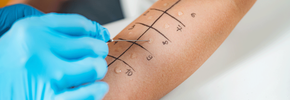 Insbesondere bei polysensibilisierten Patienten fällt eine Therapieentscheidung auf Basis der Prick-Testergebnisse meist schwer.