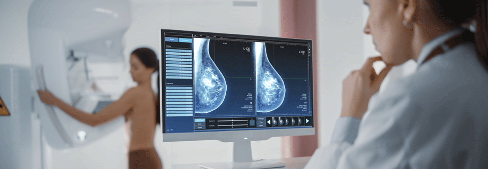 Künftig könnte KI die Radiologen bei der Auswertung von Mammographien unterstützen.
