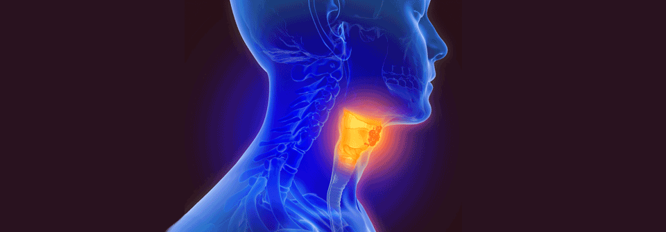 Eine Erleichterung der Diagnose  von HPV-assoziiertem Oropharynxkrebs könnte zukünftig durch einen nicht invasiven DNA-Test stattfinden.