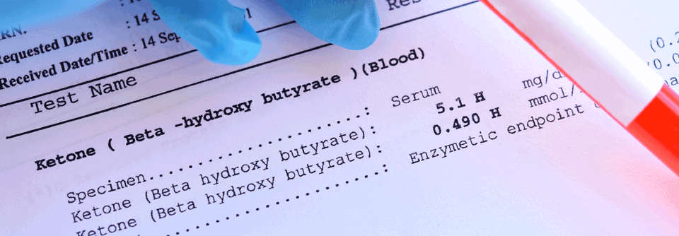 Die im Blutplasma gemessenen Ketonkörper könnten ein Parameter zur Früherkennung diabetesgefährdeter Menschen sein.