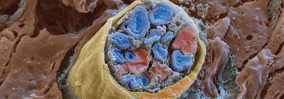 Peripherer Nerv in 7000facher Vergrößerung. Die Nervenfasern (blau) sind von Myelinscheiden (blassblau) umgeben, dazwischen liegen Schwannzellen (rot) und Bindegewebe. Perineurale Zellen (gelb) umschließen das Nervenbündel.