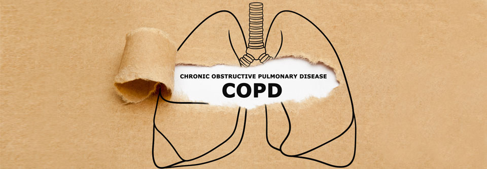 COPD-Patient:innen sollten sich regelmäßig körperlichen Belastungen aussetzen.