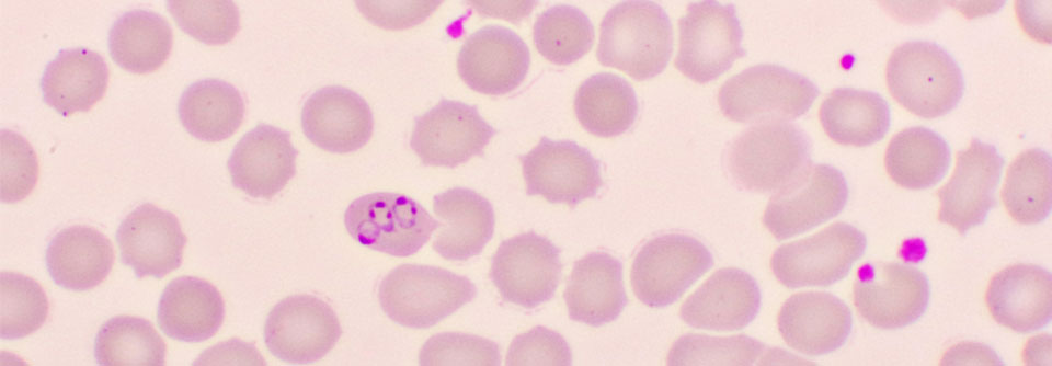 Der Malariaerreger Plasmodium falciparum entwickelt in einigen Regionen Resistenzen gegenüber Artemisinin.