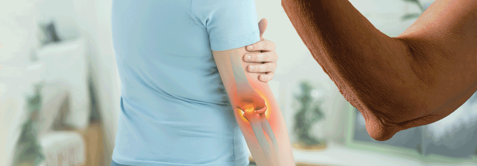 Rheumaknoten treten häufig am Ellenbogen und an der Streckseite des Unterarms auf.