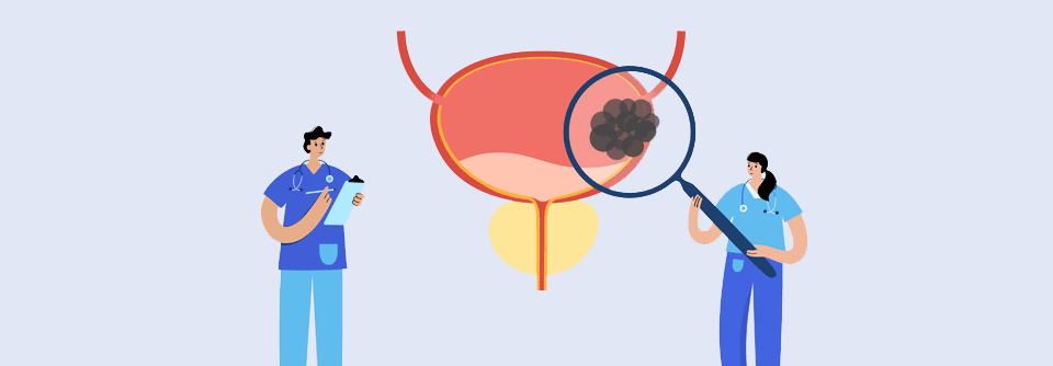 Eine Dreifach-Behandlung von Urothelkarzinom-Patient:innen kann sich positiv auswirken.