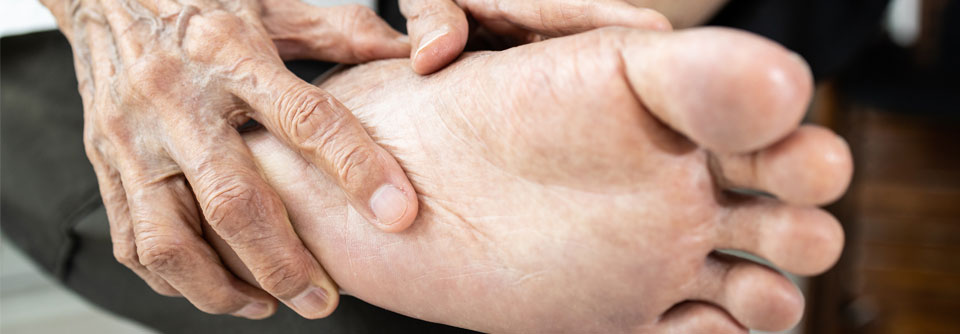 Ein brennender Oberflächenschmerz in Fuß oder Hand ist für die SFN bei Weitem nicht das einzige Symptom.