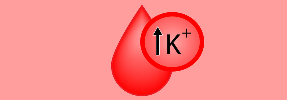 Zu Behandlung der Hyperkaliämie werden Kaliumbinder auch in nephrologischen Leitlinien empfohlen.