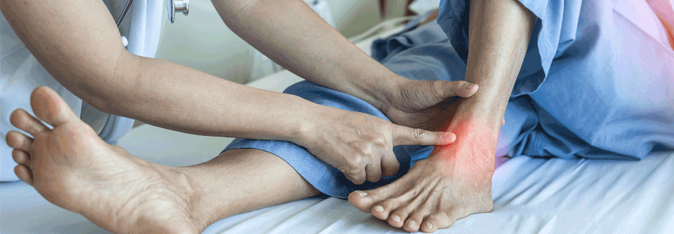 Durch Quetschung des hinteren Schienbeinnervs entstehen beim Tarsaltunnelsyndrom Schmerzen vom Fußgelenk bis in die Zehen.