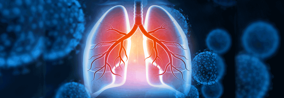 Ein Antikörper-Wirkstoff-Konjugat erwies sich in einer Studie bei Erkrankten mit EGFR-mutiertem NSCLC als wirksam.