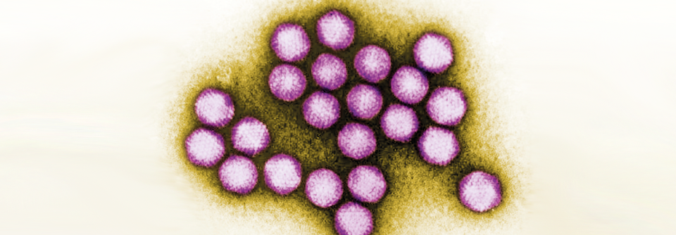 Adenoviren verursachen meistens Atemwegsinfekte, je nach Serotyp können auch weitere Organe Schaden nehmen.