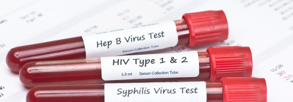 Ein Screening beim Fehlen von Symptomen sollte auf HIV und Syphilis beschränkt werden.