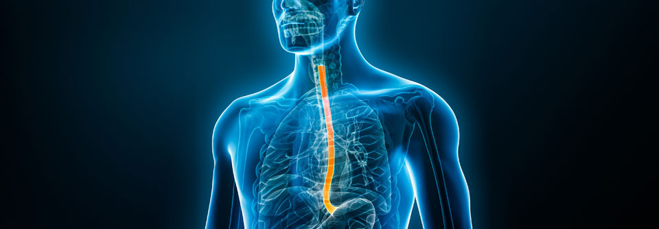 Dupilumab ist als Zweitlinientherapie bei der EoE zugelassen.