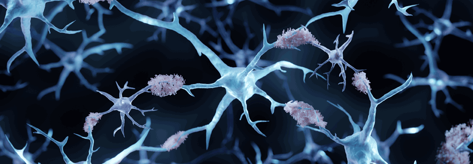 Die Endprodukte lagern sich außerhalb der Zellen als Amyloid-Transthyretin (ATTR) ab.