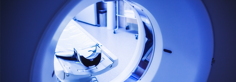 Ein Screening mittels Niedrigdosis-Computertomografie könnte die Früherkennung von Lungenkrebs fördern.