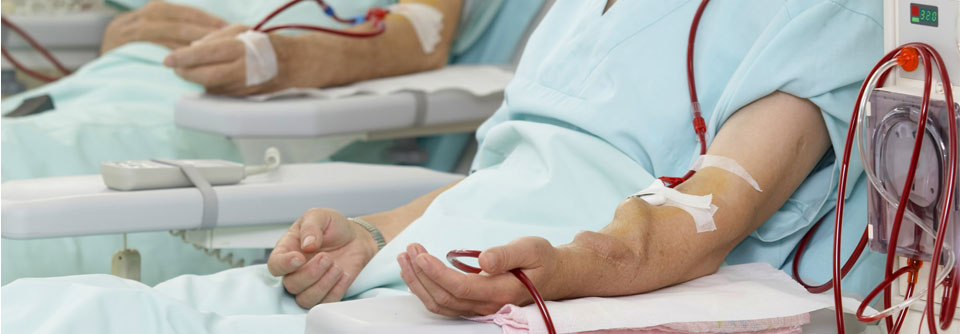 Studie: Hochdosis-Hämodiafiltration effektiver als Hämodialyse Bisher am häufigsten zur Dialysebehandlung eingesetzt: die Hämodialyse.