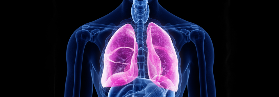 Auch asymptomatische Schleimpfropfen gehen bei COPD mit einem höheren Risiko für eine schwere Exazerbation einher.
