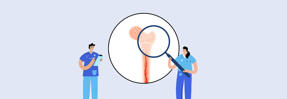 Durch ein neues Prognosemodell lassen sich zwei Gruppen von MM-Patient:innen besser identifizieren.