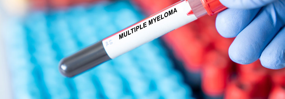 Das Multiple Myelom zeigt sich bezüglich Krankheitsbiologie und Toxizitäten genderspezifisch.