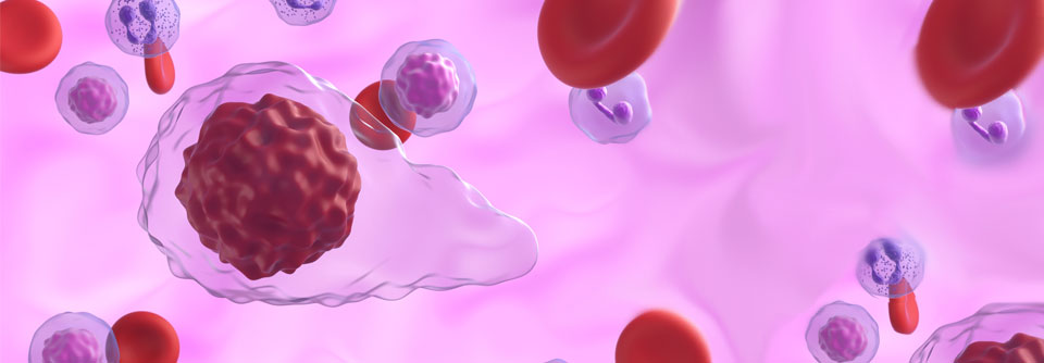 Als Therapieoption bei Myelofibrose steht nun auch Momelotinib zur Verfügung.