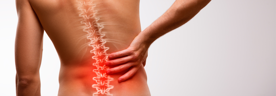 Bei anhaltenden Rückenschmerzen können auch Schädigungen der peripheren Nerven die Ursache sein.