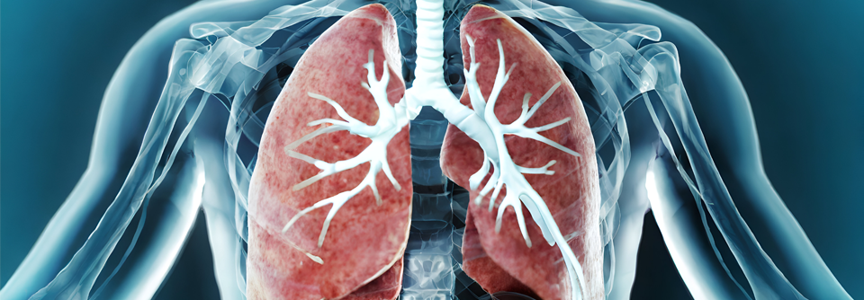 Eine frühzeitige Diagnose mit anschließender Überweisung an ein Lungentransplantationszentrum ist bei der pulmonalen venookklusiven Erkrankung unerlässlich.
