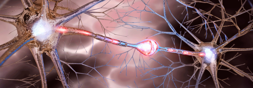 CRPS: Vier Diagnosekriterien weisen beim Schmerzsyndrom den Weg Das komplexe regionale Schmerzsyndrom (CRPS) ist eine klinische Diagnose.