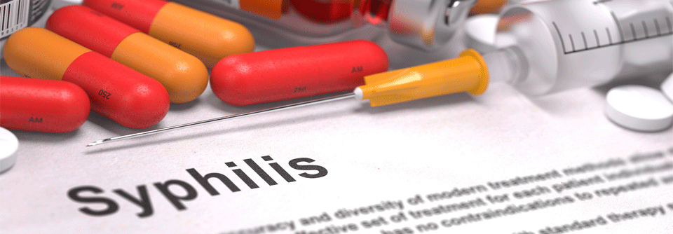 Syphilis: Die Geschichte der Franzosenkrankheit Ab Ende des 15. Jahrhunderts wütete die "Lustseuche" oder Syphilis furchtbar in ganz Europa