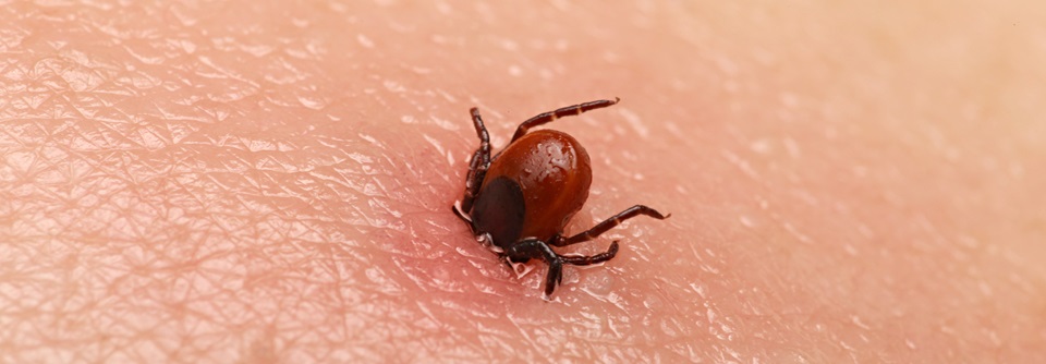 Rickettsien-Infektion: Welche Konsequenzen folgen daraus? In der alten und neuen Welt sind durch Zecken übertragene Rickettsiosen seit langem bekannt.