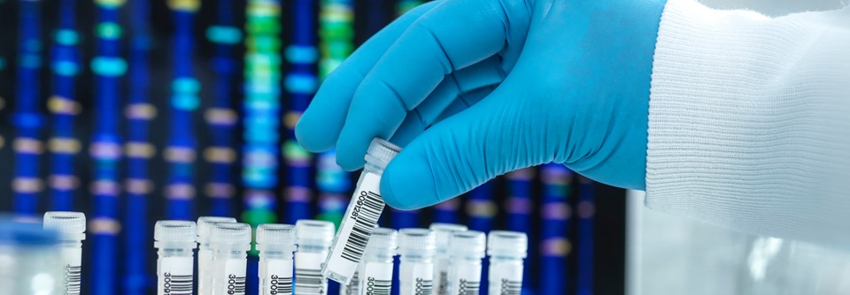 Hohes LDL-Cholesterin: Wann muss man die Gene checken? Eine weiterführende genetische Diagnostik macht immer dann Sinn, wenn es zusätzlich jüngere Familienangehörige gibt, die von einer frühzeitigen Diagnose profitieren.