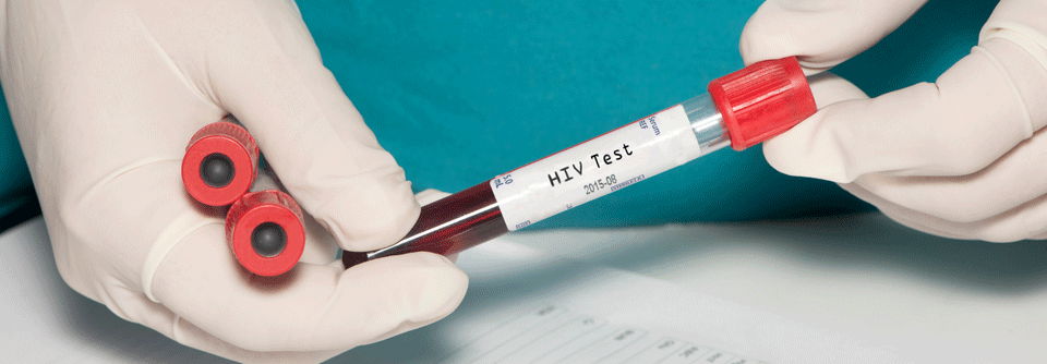 HIV: Etwas mehr HIV-Infizierte Im Jahr 2019 haben sich geschätzt 2.600 Personen in Deutschland mit HIV infiziert
