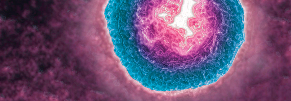 Zoster ophthalmicus: Was durch die VZV-Suppression erreichbar ist Das Varizella-Zoster-Virus ist für den Zoster ophthalmicus und die Post-Zoster-Neuralgie verantwortlich.