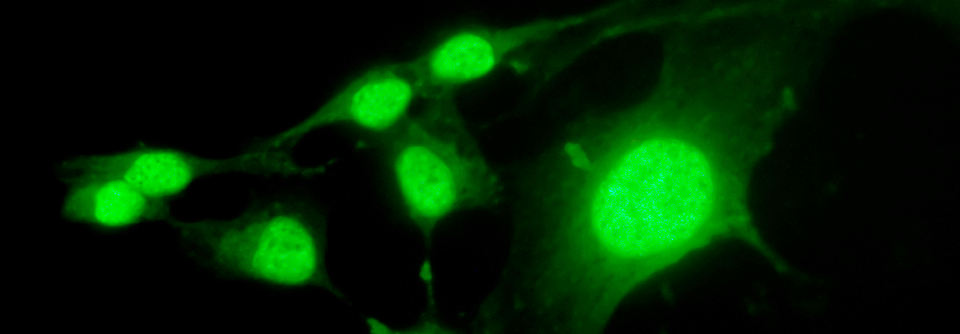 Epitheliale Tumoren: Tumormarker lässt Krebszellen aufleuchten Fluoreszenzmarkiertes Olaparib-Derivat färbt epithelial Tumoren für Früherkennung und intraoperative Diagnostik.