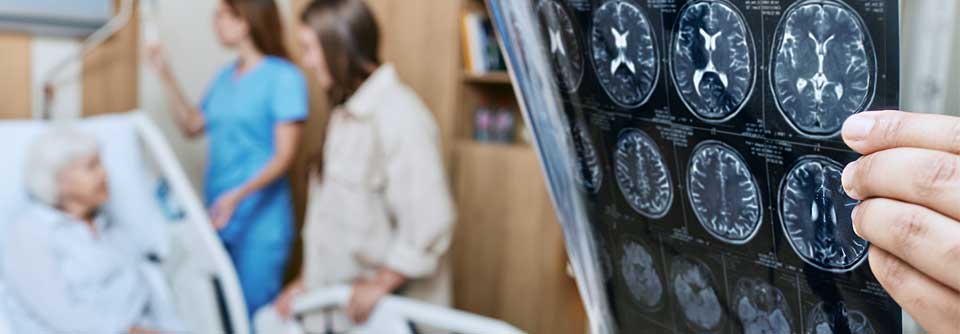 Schon früher hatten Studien gezeigt, dass die Kombination von Aspirin und Clopidrogrel im Hinblick auf die Rezidivprophylaxe überlegen ist.