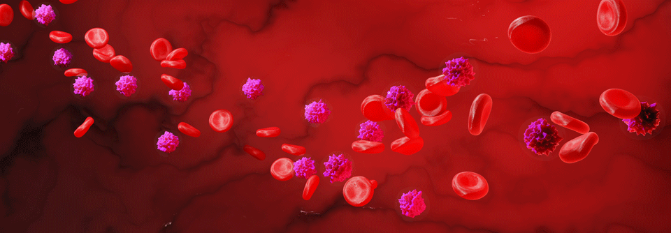 Venetoclax-basierte Kombinationen in der CLL-Erstlinientherapie weiterhin Standard Erkrankte mit Hochrisikofaktoren profitieren eventuell besonders von intensivierten Therapieregimen.