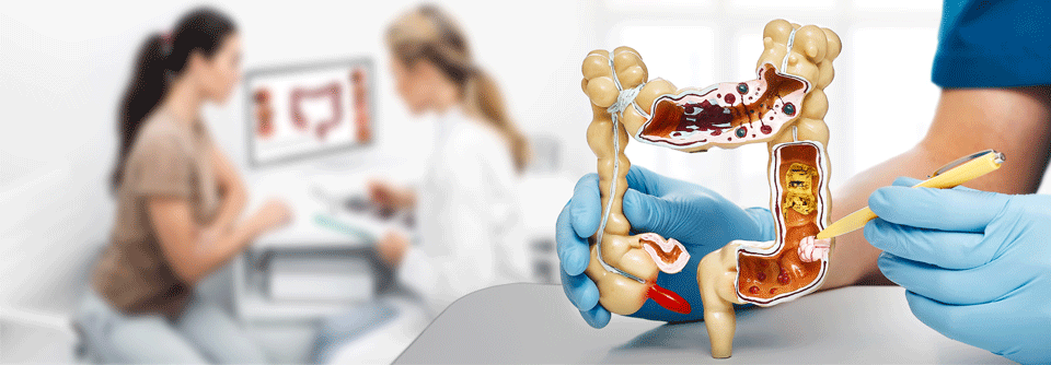 Voraussichtlich im Lauf des Jahres 2019 können Männer früher ein Darmkrebs-Screening vornehmen lassen.