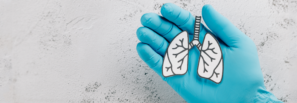 Interstitielle Lungenerkrankung bei rheumatoider Arthritis früh erkennen Husten und Dyspnoe sind bei RA offenbar keine besonders zuverlässigen Prädiktoren für interstitielle Lungenveränderungen.