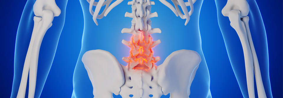axSpA: Noch schwer zu behandeln oder schon therapieresistent? Noziplastische oder neuropathische Schmerzen am Werk