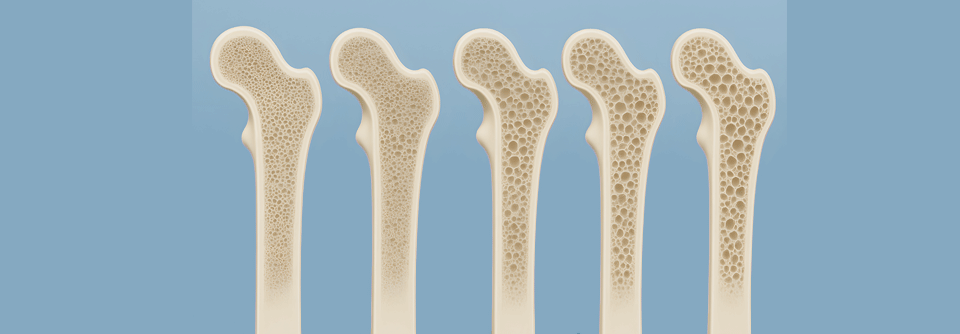 Bei älteren Frauen, die ein Probiotikum einnehmen, verringert sich die Knochendichte langsamer.