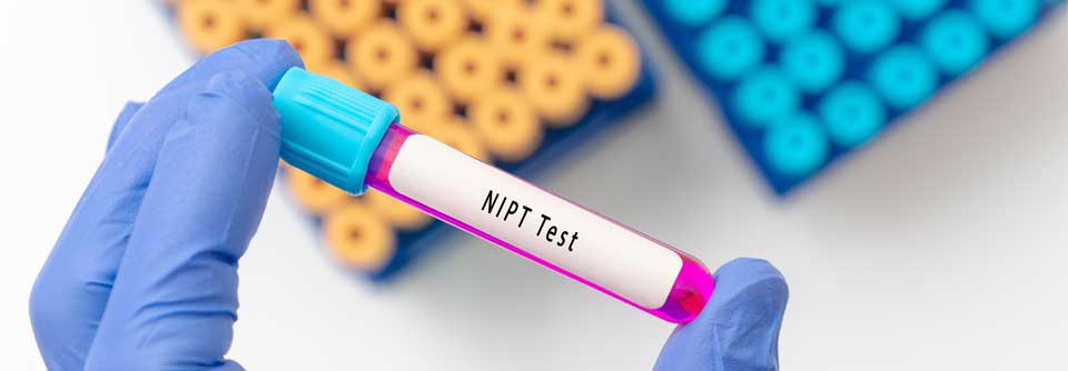 Nicht invasive Test sind mit über 99 % ähnlich sensitiv und spezifisch wie die invasiven Methoden.