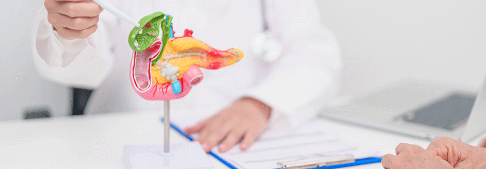 Die meisten Pankreaskarzinom-Fälle werden spät diagnostiziert – neue Therapien könnten die Prognose verbessern.