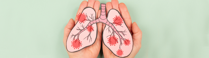 Der neue Activin-Signalweg-Inhibitor Sotatercept  bringt nach neusten Ergebnissen auch Vorteile bei fortgeschrittenen Stadien der pulmonalarteriellen Hypertonie.